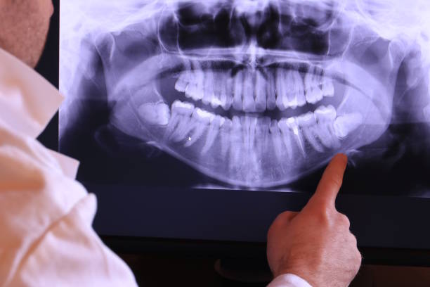 Best Emergency Dental Services for Seniors in Custer, SD