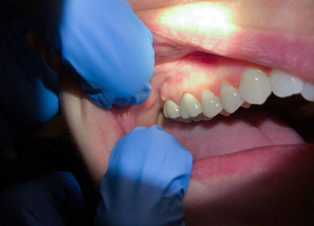 Best Emergency Dentist for Special Needs Patients in Custer, SD